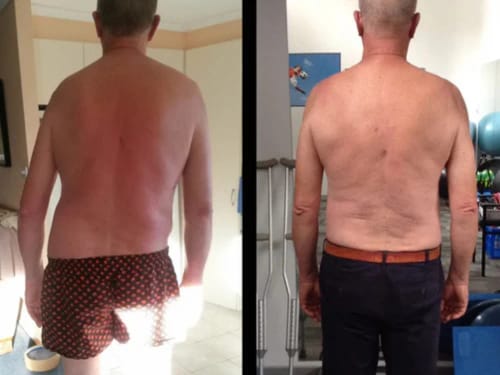 Customer photo review of Myovia Adaptive Correction System