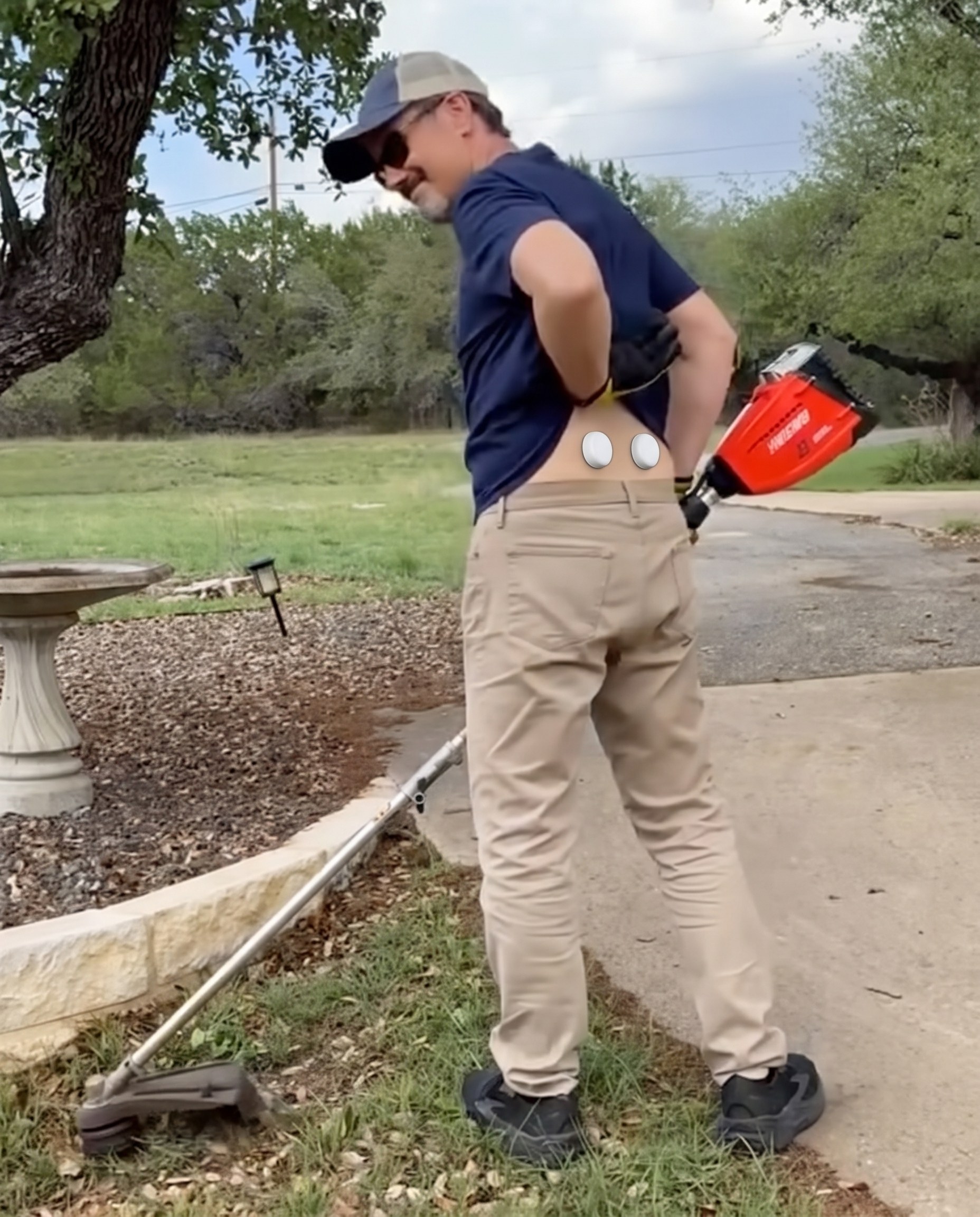 Customer photo review of Myovia Adaptive Correction System